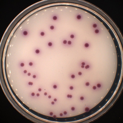 Alfred-Wegener-Institut / Antje Wichels | Serial dilution of enrichment cultures on selective Vibrio chromogenic media. The mauve-coloured colonies are indicators for Vibrio parahaemolyticus, originating from a microplastics sample from the North Sea.