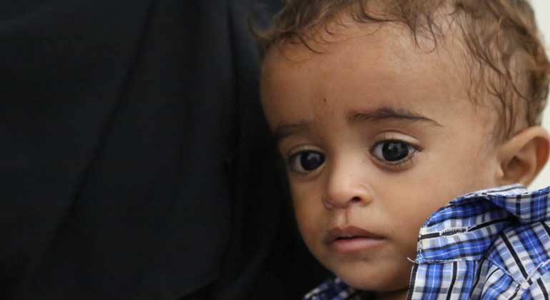 WFP Alarmed At Growing Rates Of Hunger And Malnutrition In War-Torn Yemen