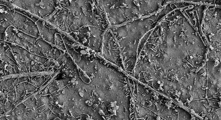 Electron microscopy images: ETH Zurich / Environmental Chemistry Group | After a few weeks in soils, numerous soil microorganisms colonized the surface of the PBAT films and had begun to biodegrade the polymer.