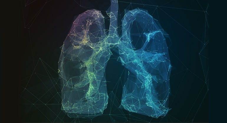 Depositphotos | mirexonlife | Abstraktes Bild menschlichen Lunge in Form von Linien-Kommunikationsnetz
